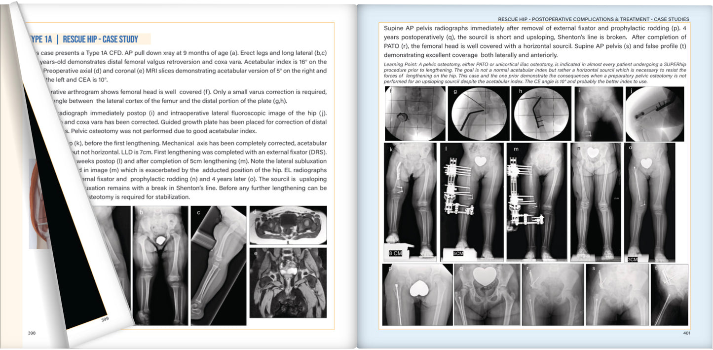 Congenital Deficiencies & Deformities Course + CFD Book Bundle