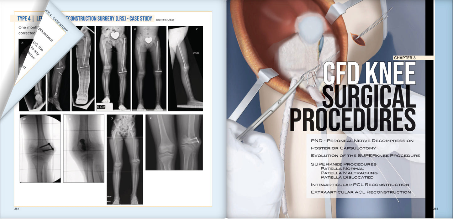 Congenital Deficiencies & Deformities Course + CFD Book Bundle