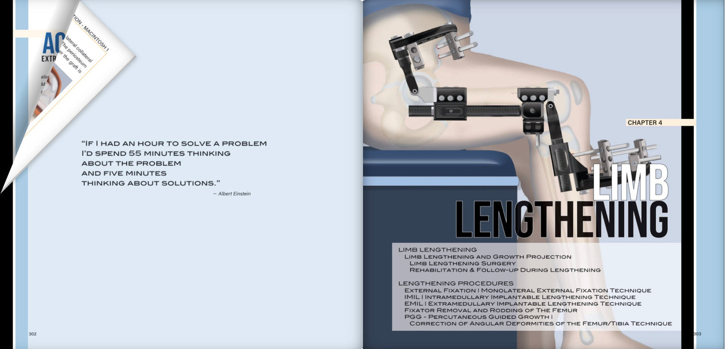 CFD Congenital Femoral Deficiency, First Edition (Event Discount Used)